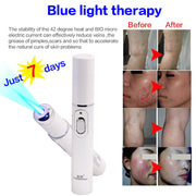 Acne Wrinkle Removal Laser Pen Skin