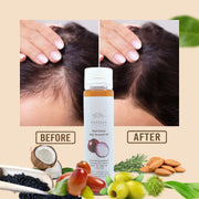 Hair Growth Serum