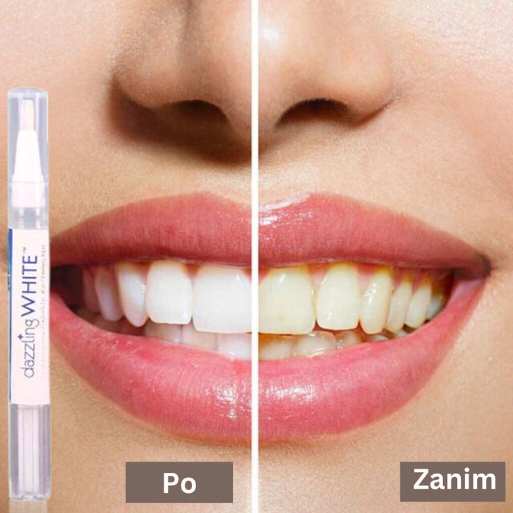 Dazzling Teeth Whitening Pen